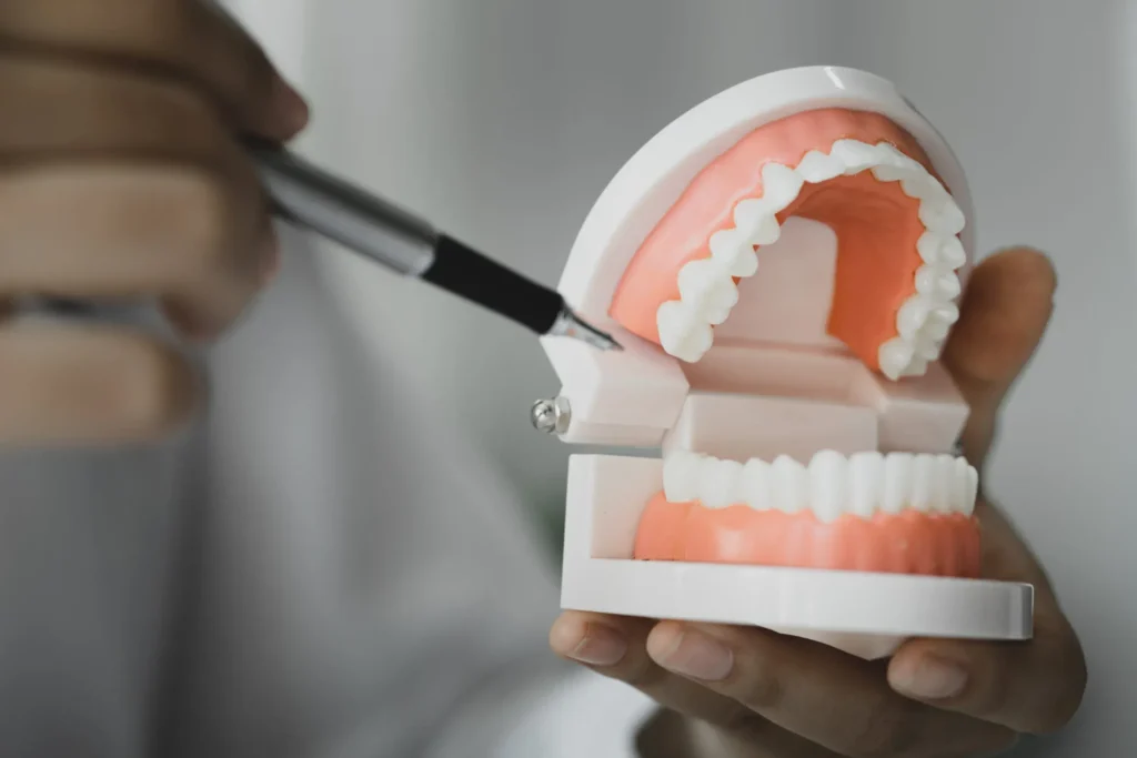 Cheap vs Quality Dental Implants in Abbotsford: What to Choose