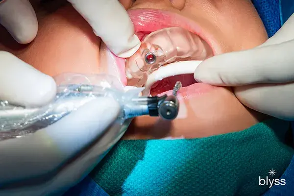 How Painful Are Dental Implants? Full Patient Guide