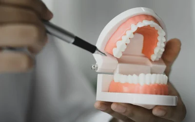 Cheap vs Quality Dental Implants in Abbotsford: What to Choose
