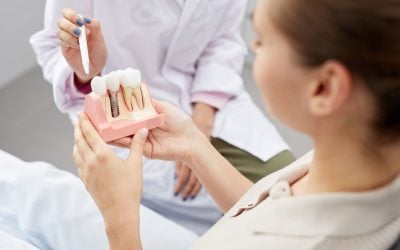 How Long Do Dental Implants Last? Key Factors to Consider 