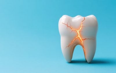 What Is the Most Common Dental Emergency and How to Handle It 
