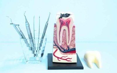 Do I Need a Crown After a Root Canal? Essential Information for Patients