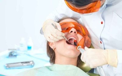 How Many Times Can a Tooth Be Filled? Understanding Limits and Factors