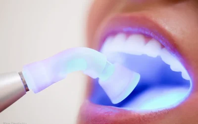 How Much Does a Dental Bridge Cost in 2026? Complete Price Guide