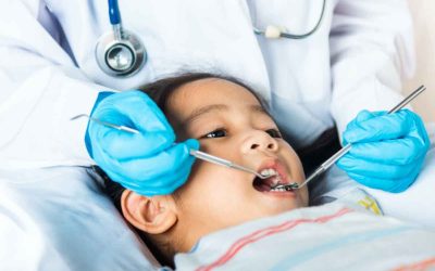 Is it Normal for a 4 Year Old to Have Cavities?