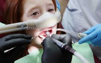 Do They Put You to Sleep for a Root Canal? A Dentist Explains