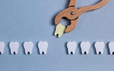 Surgical extraction of sick bad tooth with forceps. Teeth decay, infection. Dental problems concept. Oral hygiene concept. Kids toy. High quality photo