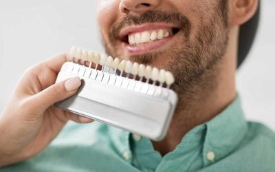 dentist checking teeth shades
